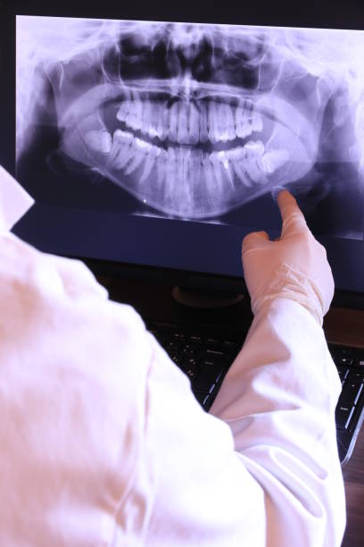 Best Emergency Treatment for Dental Infections or Abscesses in South Roxana, IL
