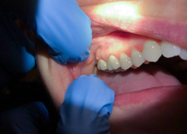 Best Weekend Emergency Dentist in South Roxana, IL