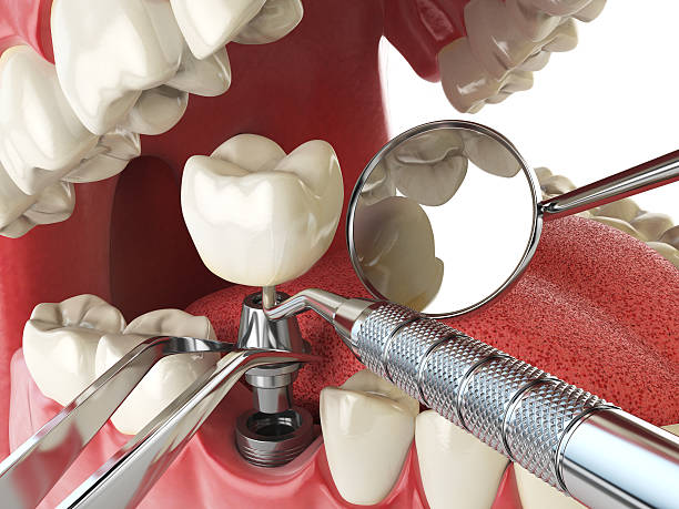 Best Weekend Emergency Dentist in South Roxana, IL